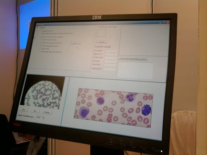 Software UI for leukocyte counts and live microscope capture